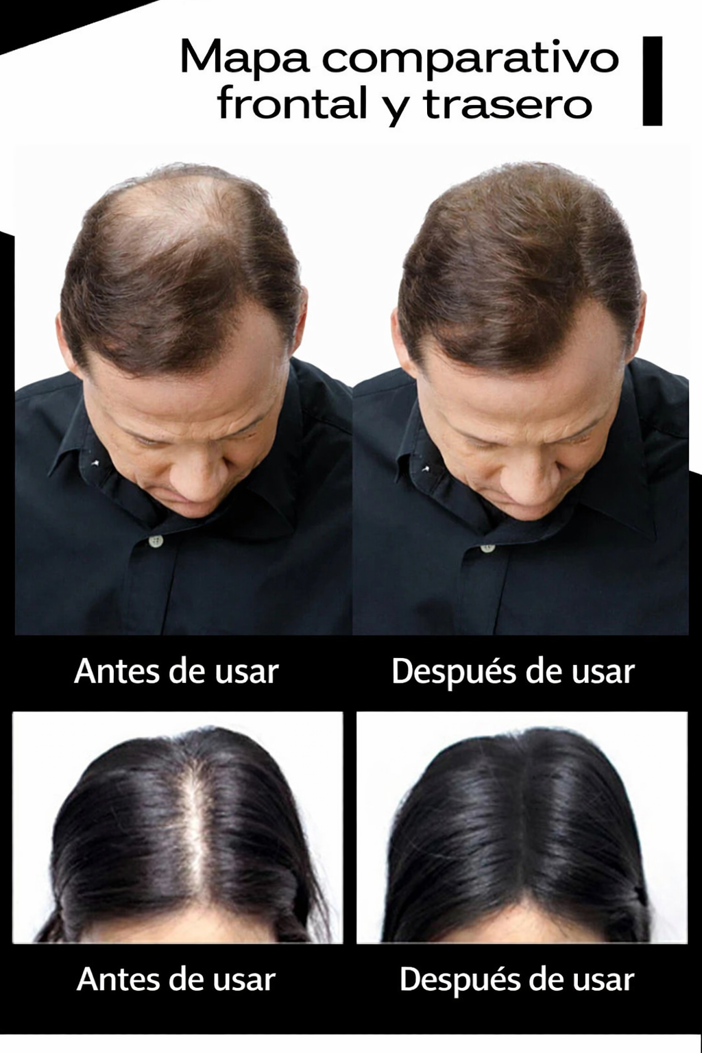 Fibra capilar