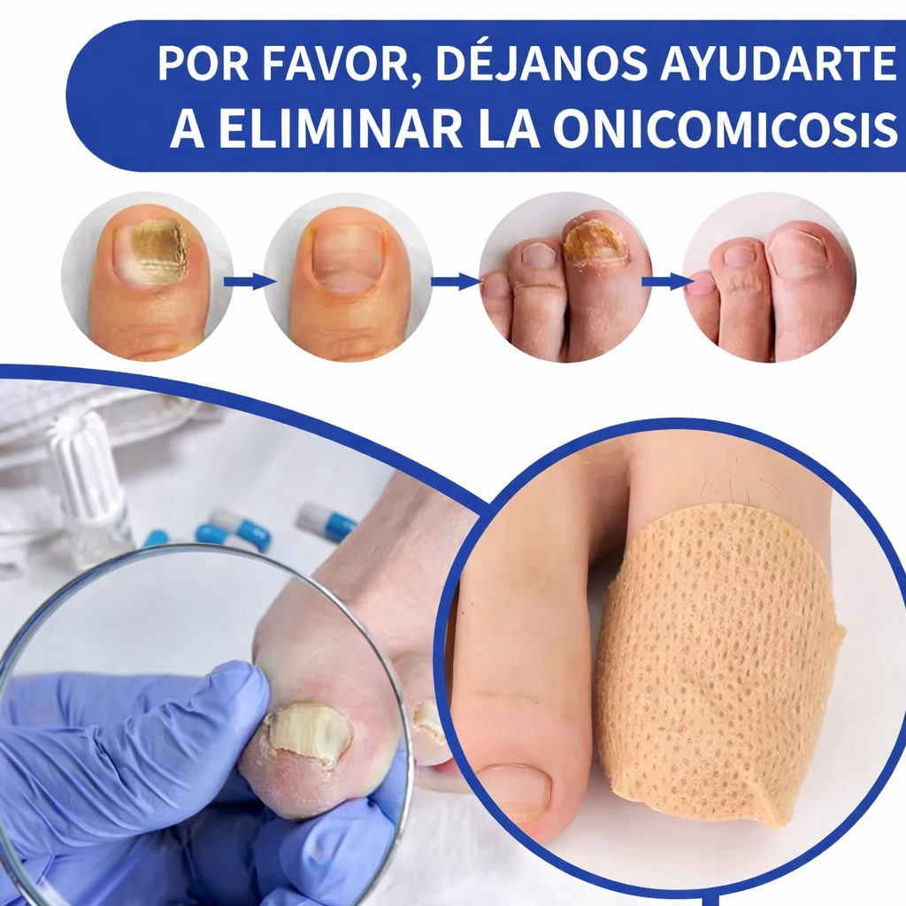 parches para hongos en las uñas